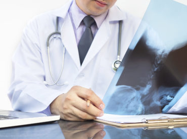 Doctor examine x-ray film over white background